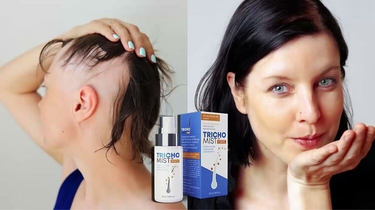 Poland - trichomist forte forum